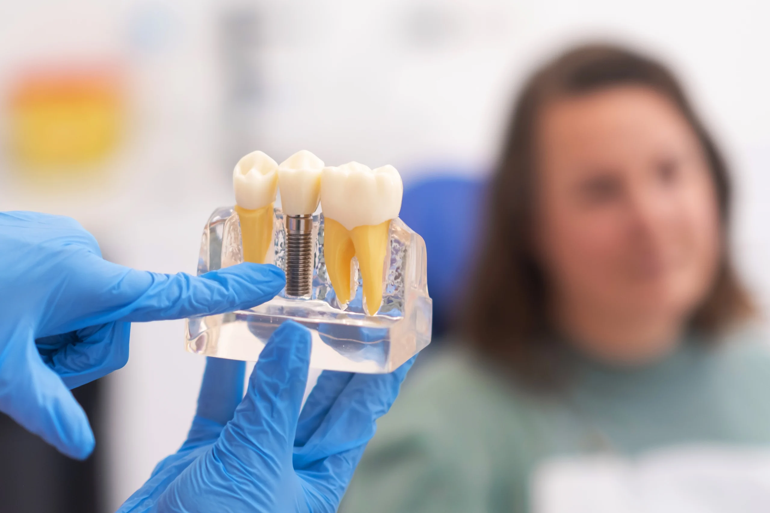 Implante dentário em destaque